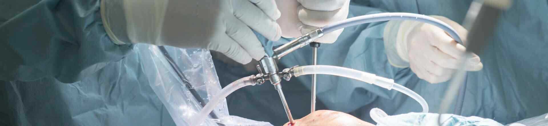 Arthroscopic Surgery