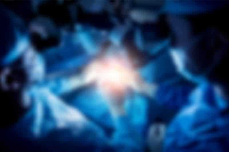 Epilepsy Surgery
