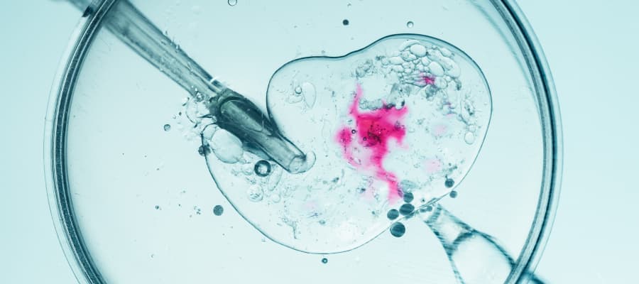 ინ ვიტრო განაყოფიერება (IVF)