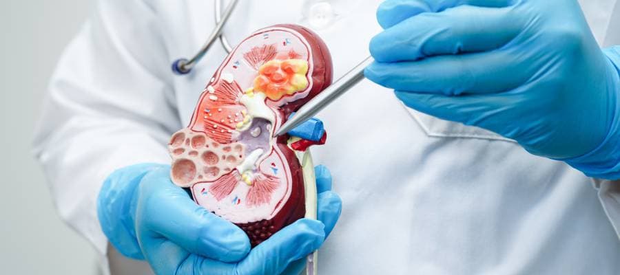 Prostate Surgery