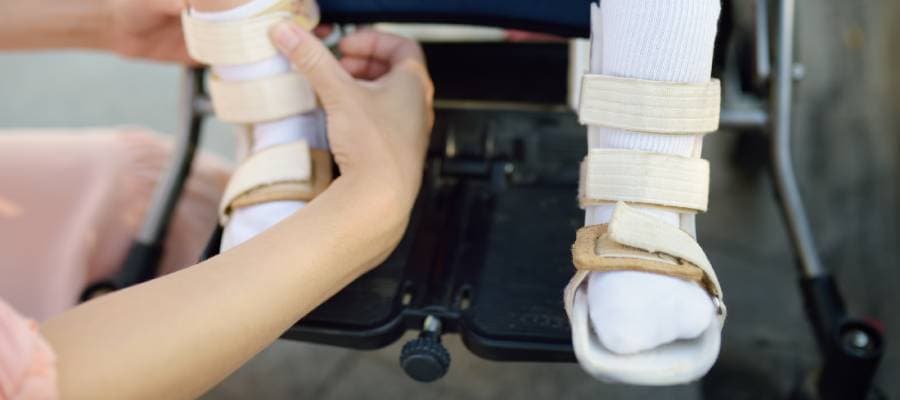 Amputee Rehabilitation