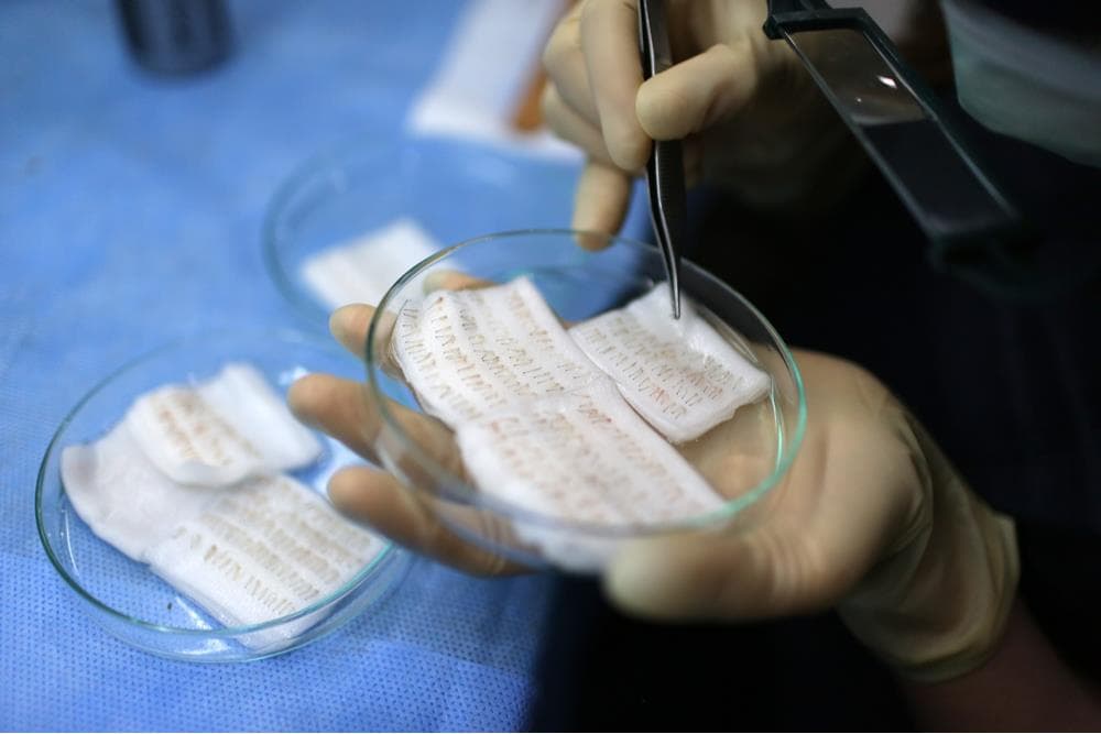 FUE Hair Transplant