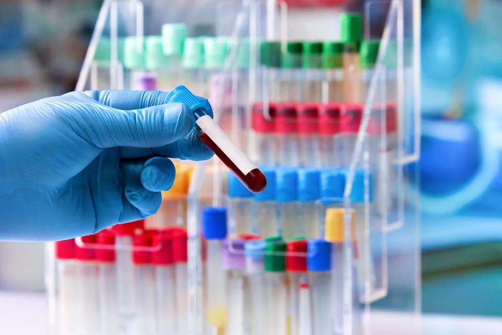 Hematología