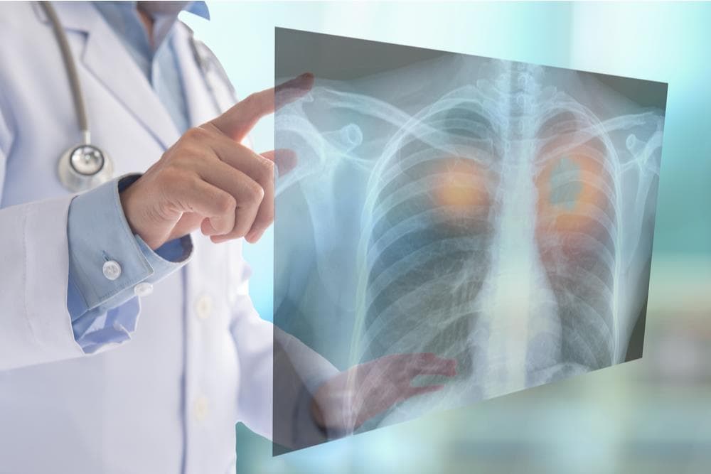 Thoracic Surgery